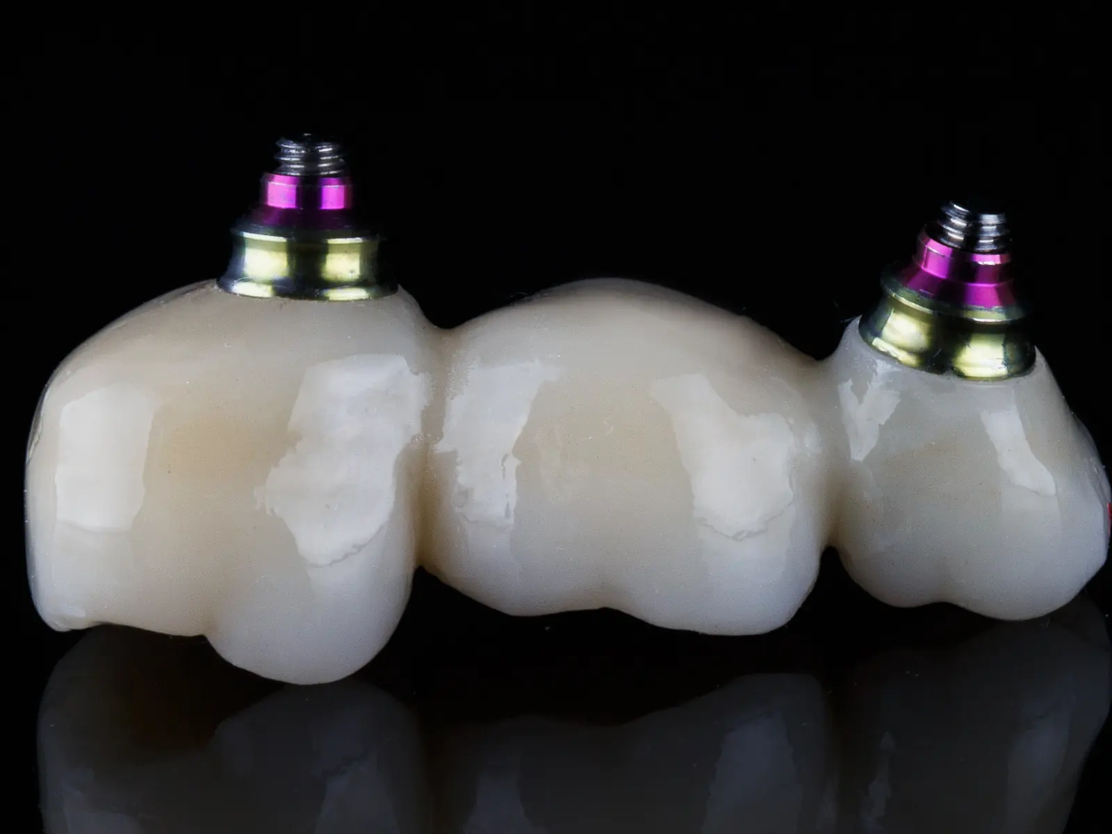 The finished zirconia bridge on titanium abutments, photographed on black glass